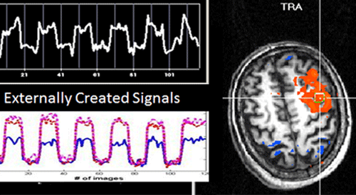 brain waves and brain scan